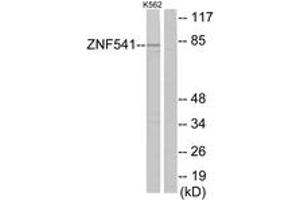 Western blot analysis of extracts from K562 cells, using ZNF541 Antibody. (ZNF541 Antikörper  (AA 931-980))