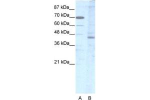 Western Blotting (WB) image for anti-LIM Homeobox 2 (LHX2) antibody (ABIN2463841) (LHX2 Antikörper)