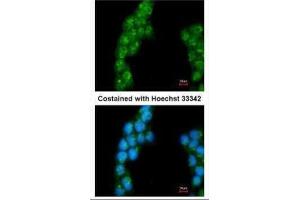 ICC/IF Image Immunofluorescence analysis of methanol-fixed A431, using Proteasome 26S S3, antibody at 1:200 dilution. (Proteasome 26S S3 (Center) Antikörper)