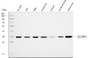 Western blot analysis of SCAMP1 using anti-SCAMP1 antibody (ABIN7599176).