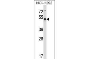 ACTR6 Antibody (C-term) (ABIN657810 and ABIN2846778) western blot analysis in NCI- cell line lysates (35 μg/lane). (ACTR6 Antikörper  (C-Term))
