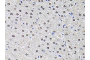 Immunohistochemistry of paraffin-embedded rat liver using HUS1 antibody (ABIN6131776, ABIN6142084, ABIN6142086 and ABIN6218116) at dilution of 1:100 (40x lens). (HUS1 Antikörper  (AA 1-280))