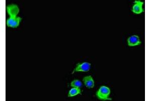Immunofluorescent analysis of Hela cells using ABIN7150193 at dilution of 1:100 and Alexa Fluor 488-congugated AffiniPure Goat Anti-Rabbit IgG(H+L) (LIG3 Antikörper  (AA 809-928))