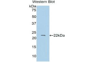 Western Blotting (WB) image for anti-Protein S (PROS) (AA 301-476) antibody (ABIN1175271) (PROS1 Antikörper  (AA 301-476))