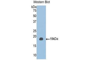 Western Blotting (WB) image for anti-Chloride Intracellular Channel 4 (CLIC4) (AA 104-253) antibody (ABIN1077929) (CLIC4 Antikörper  (AA 104-253))