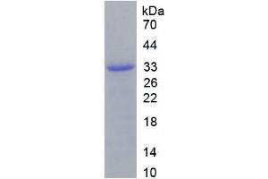 SDS-PAGE analysis of Mouse Integrin beta 2 Protein.