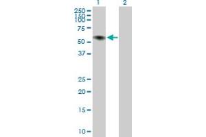Western Blot analysis of ILDR1 expression in transfected 293T cell line ( H00286676-T02 ) by ILDR1 MaxPab polyclonal antibody. (ILDR1 Antikörper  (AA 1-502))