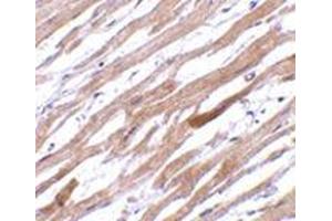 Immunohistochemistry of TIRAP in human heart tissue with this product at 20 μg/ml.