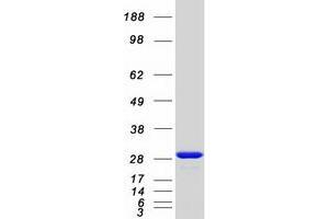 Validation with Western Blot (CALB1 Protein (Myc-DYKDDDDK Tag))