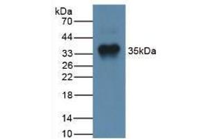 Western blot analysis of Human Liver Tissue. (MSTN Antikörper  (AA 266-375))