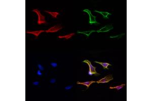 ABIN6265225 and ABIN6277101 staining Hela cells by IF/ICC.