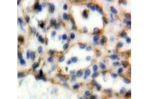 Used in DAB staining on fromalin fixed paraffin-embedded Spleen tissue (CD72 Antikörper  (AA 169-359))