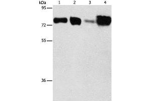 Western Blot analysis of Hepg2 and hela cell, Human fetal kidney and liver tissue using ACSL4 Polyclonal Antibody at dilution of 1:650