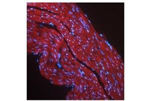 Immunofluorescence (IF) image for anti-Insulin-Like Growth Factor 1 Receptor (IGF1R) (Middle Region) antibody (ABIN926846)