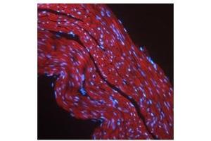 IGF1R antibody used at a concentration of 2-10 ug/ml to detect mouse skeletal muscle (red).