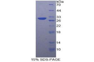 SDS-PAGE (SDS) image for serpin Peptidase Inhibitor, Clade D (Heparin Cofactor), Member 1 (SERPIND1) (AA 276-499) protein (His tag) (ABIN1879013) (SERPIND1 Protein (AA 276-499) (His tag))