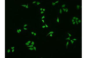 Immunofluorescence staining of HepG2 cells with ABIN7161520 at 1:100, counter-stained with DAPI. (NFKBIA Antikörper  (AA 27-317))