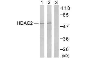 Western blot analysis of extracts from HeLa cells (Lane 1) and 293 cells (Lane 2 and 3), using HDAC2 (Ab-394) antibody (E021140). (HDAC2 Antikörper)