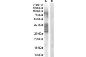 Western Blotting (WB) image for anti-ADAM Metallopeptidase Domain 33 (ADAM33) (AA 637-650) antibody (ABIN296643) (ADAM33 Antikörper  (AA 637-650))