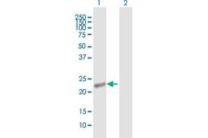 Western Blotting (WB) image for APOBEC3B 293T Cell Transient Overexpression Lysate(Denatured) (ABIN1334607)