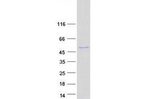 Western Blotting (WB) image for Enolase 3 (Beta, Muscle) (ENO3) (Transcript Variant 2) protein (Myc-DYKDDDDK Tag) (ABIN2720195)