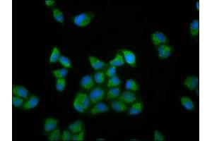 Immunofluorescence staining of Hela cells with ABIN7166026 at 1:133, counter-stained with DAPI. (RUFY3 Antikörper  (AA 243-352))