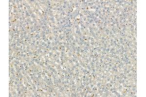ABIN7093170 and ABIN7098475 at 1/100 staining Rat liver tissue by IHC-P. (C3 Antikörper  (Internal Region))