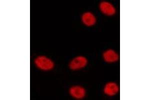 ABIN6275329 staining HepG2 by IF/ICC. (NOLC1 Antikörper  (C-Term))