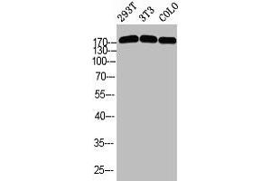 Western blot analysis of 293T 3T3 COLO using p-Topo IIα (S1525) antibody. (Topoisomerase II alpha Antikörper  (pSer1525))