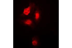 Immunofluorescent analysis of p38 (pT180) staining in HepG2 cells.
