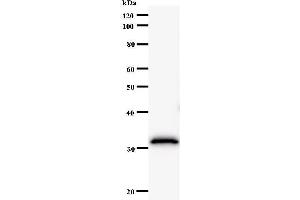 Western Blotting (WB) image for anti-F-Box and Leucine-Rich Repeat Protein 4 (FBXL4) antibody (ABIN931099) (FBXL4 Antikörper)