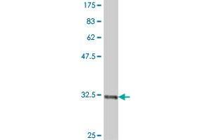 Western Blotting (WB) image for anti-Transient Receptor Potential Cation Channel, Subfamily C, Member 1 (TRPC1) (AA 442-505) antibody (ABIN563261)