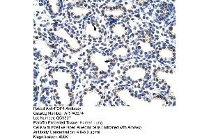 Immunohistochemistry (IHC) image for anti-Processing of Precursor 4, Ribonuclease P/MRP Subunit (POP4) (C-Term) antibody (ABIN2779004)