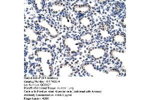 Rabbit Anti-POP4 Antibody  Paraffin Embedded Tissue: Human Lung Cellular Data: Alveolar cells Antibody Concentration: 4. (RPP29 Antikörper  (C-Term))