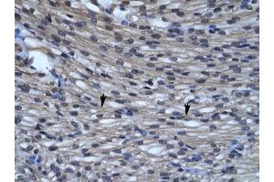 CLIC5 antibody was used for immunohistochemistry at a concentration of 4-8 ug/ml to stain Myocardial cells (arrows) in Human Heart. (CLIC5 Antikörper  (C-Term))