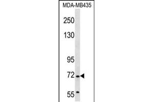 Western blot analysis in MDA-MB435 cell line lysates (35ug/lane).