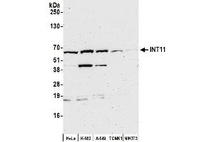 Western Blotting (WB) image for anti-Cleavage and Polyadenylation Specific Factor 3-Like (CPSF3L) (AA 550-600) antibody (ABIN7453583)