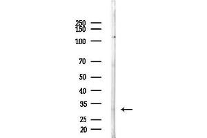 anti-Fast Skeletal Troponin T (TNNT3) (C-Term) antibody