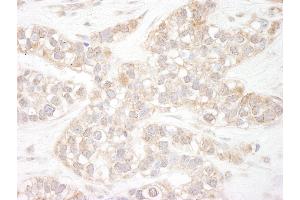 anti-Flightless I Homolog (FLII) (AA 425-475) antibody