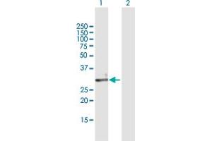 Western Blot analysis of ECH1 expression in transfected 293T cell line by ECH1 MaxPab polyclonal antibody. (ECH1 Antikörper  (AA 1-328))