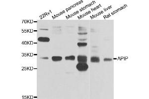 Western blot analysis of extracts of various cell lines, using APIP antibody. (APIP Antikörper)