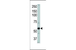 Western blot of ACVRL1 Pab (ABIN392241 and ABIN2841932). (ACVRL1 Antikörper  (N-Term))