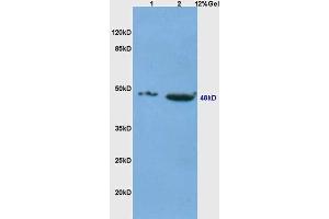 Lane 1: Mouse Thymus Lane 2: Mouse embryo probed with Anti-CD4 Polyclonal Antibody  at 1:5000 for 90 min at 37˚C. (CD4 Antikörper  (AA 301-400))