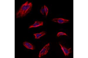 ABIN6263228 and ABIN6273139 staining Hela by IF/ICC.