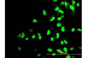 Immunofluorescence of monoclonal antibody to POLR1C on HeLa cell. (POLR1C Antikörper  (AA 1-346))