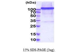 SDS-PAGE (SDS) image for CD163 (CD163) (AA 42-1050) protein (His tag) (ABIN6388130) (CD163 Protein (CD163) (AA 42-1050) (His tag))
