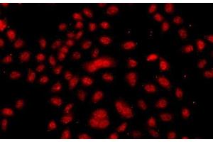 Immunofluorescence analysis of A549 cells using FBXW11 Polyclonal Antibody (FBXW11 Antikörper)