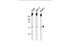 All lanes : Anti-KILLIN Antibody (C-term) at 1:500 dilution Lane 1: A549 whole cell lysate Lane 2: MCF-7 whole cell lysate Lane 3: Molt-4 whole cell lysate Lysates/proteins at 20 μg per lane.