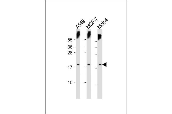 KLLN antibody  (C-Term)
