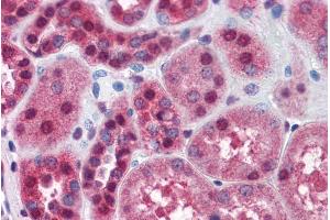 Immunohistochemistry (IHC) image for anti-FK506 Binding Protein 4, 59kDa (FKBP4) (C-Term) antibody (ABIN335136)